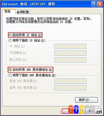 把IP地址设置为自动获得